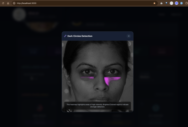 Dark Circle Detection